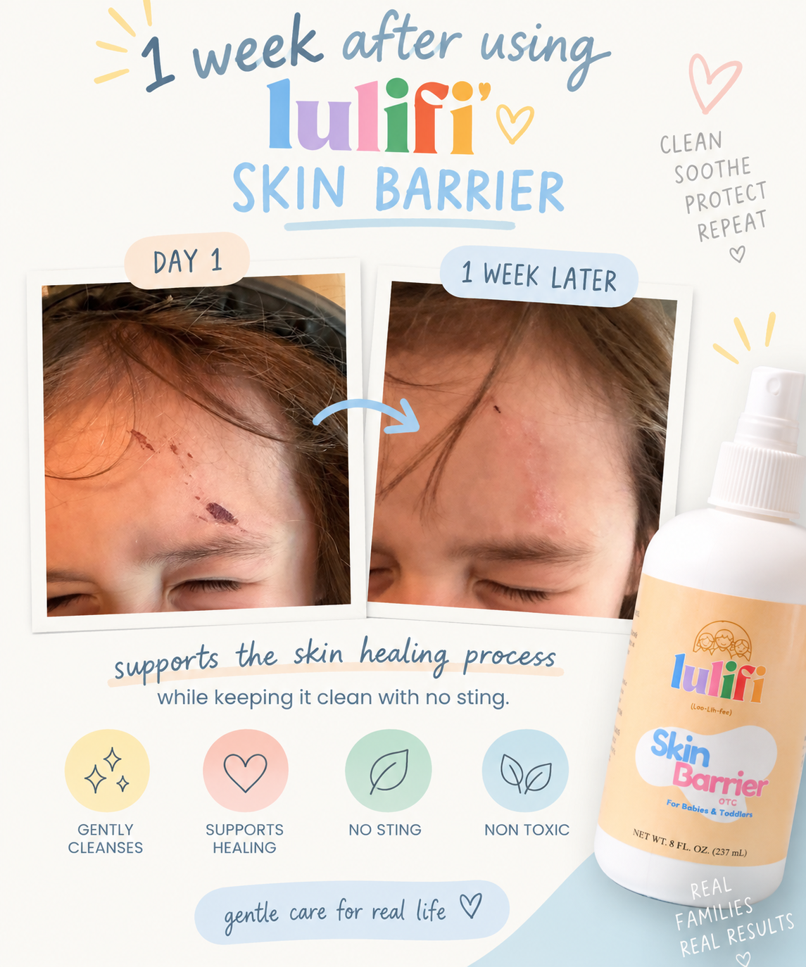 Skin Barrier Spray: Gentle Skincare for Everyday Mishaps 8oz