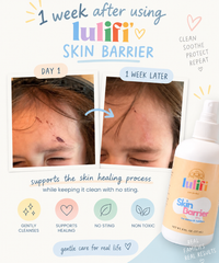 Skin Barrier Spray: Gentle Skincare for Everyday Mishaps 8oz