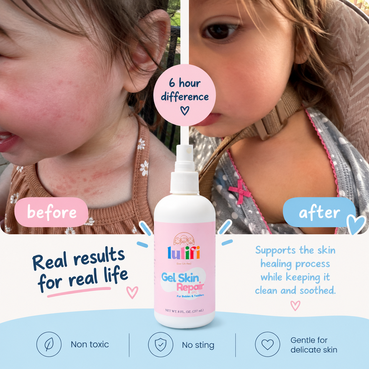Gel Repair: Gentle Skin Repair for Everyday Mishaps 8oz